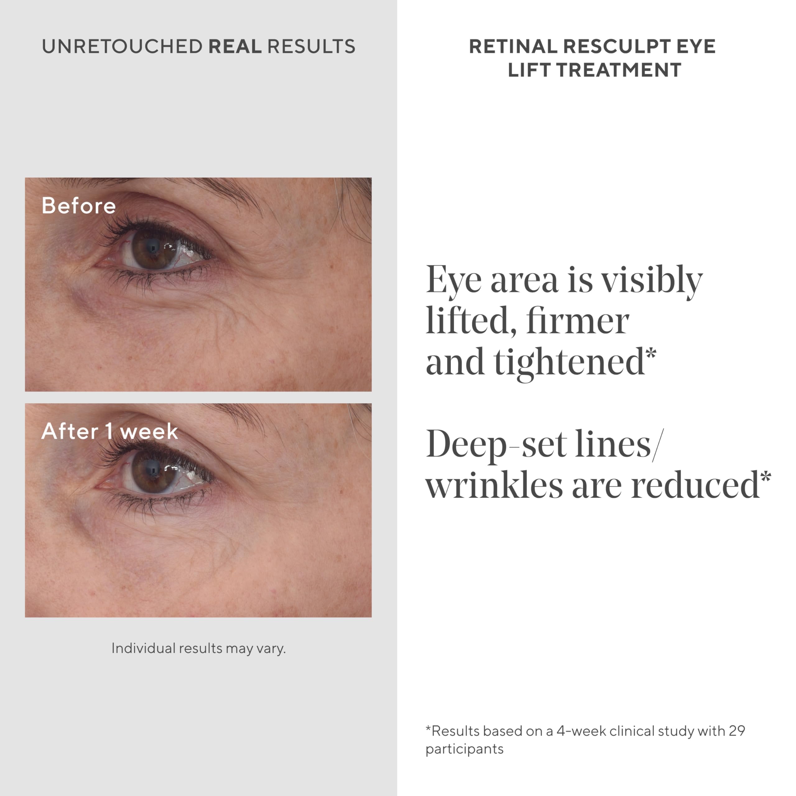 Murad Retinal ReSculpt application close-up demonstrating precise eyelid use