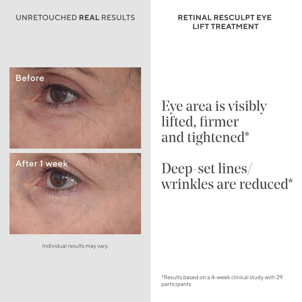 Murad Retinal ReSculpt application close-up demonstrating precise eyelid use