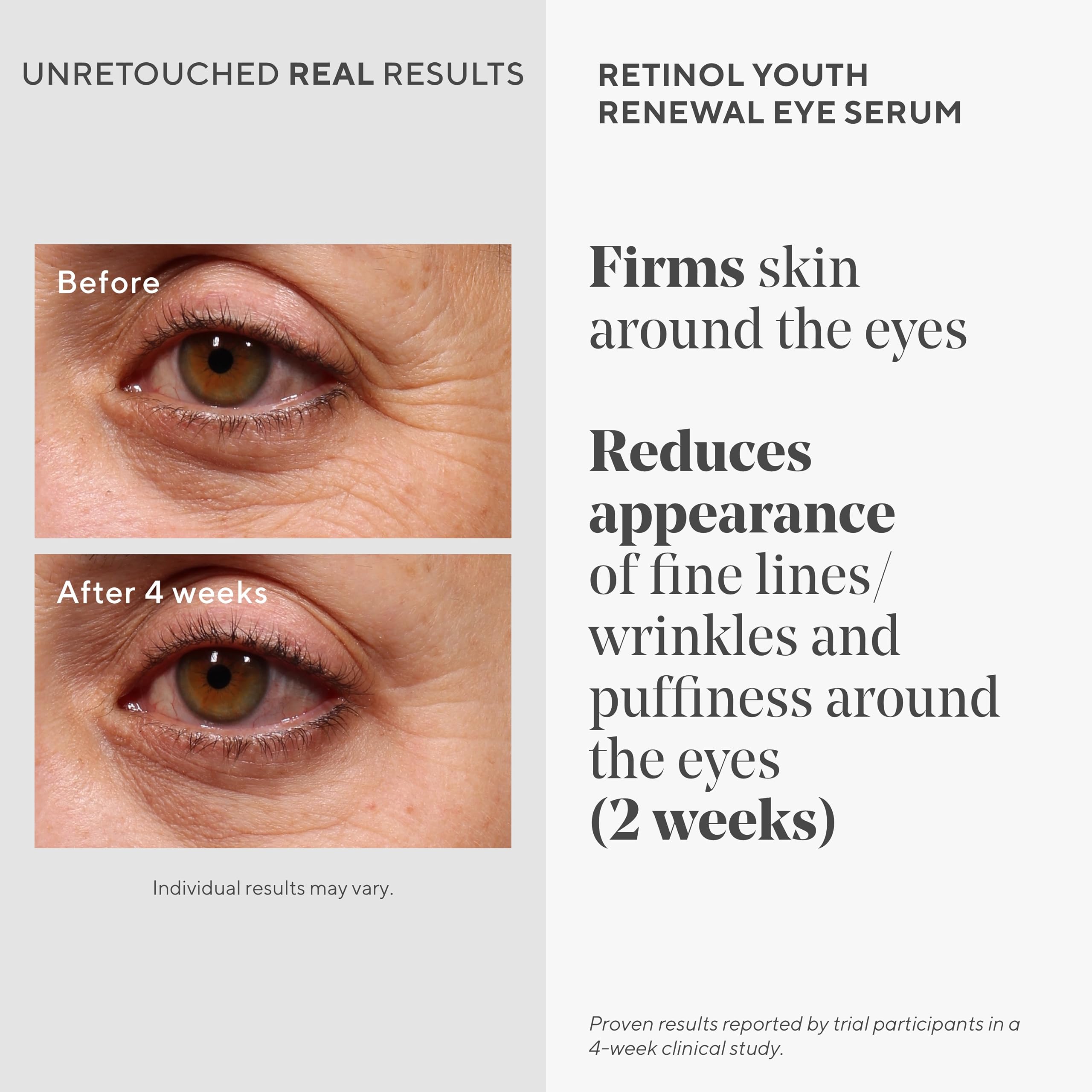 Murad Retinol Youth Renewal Eye Serum applied to under-eye area for smoother look.