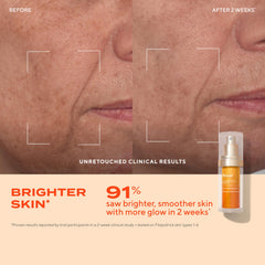 Murad Vita-C Glycolic Serum gold-stabilized C highlights potent antioxidant protection.