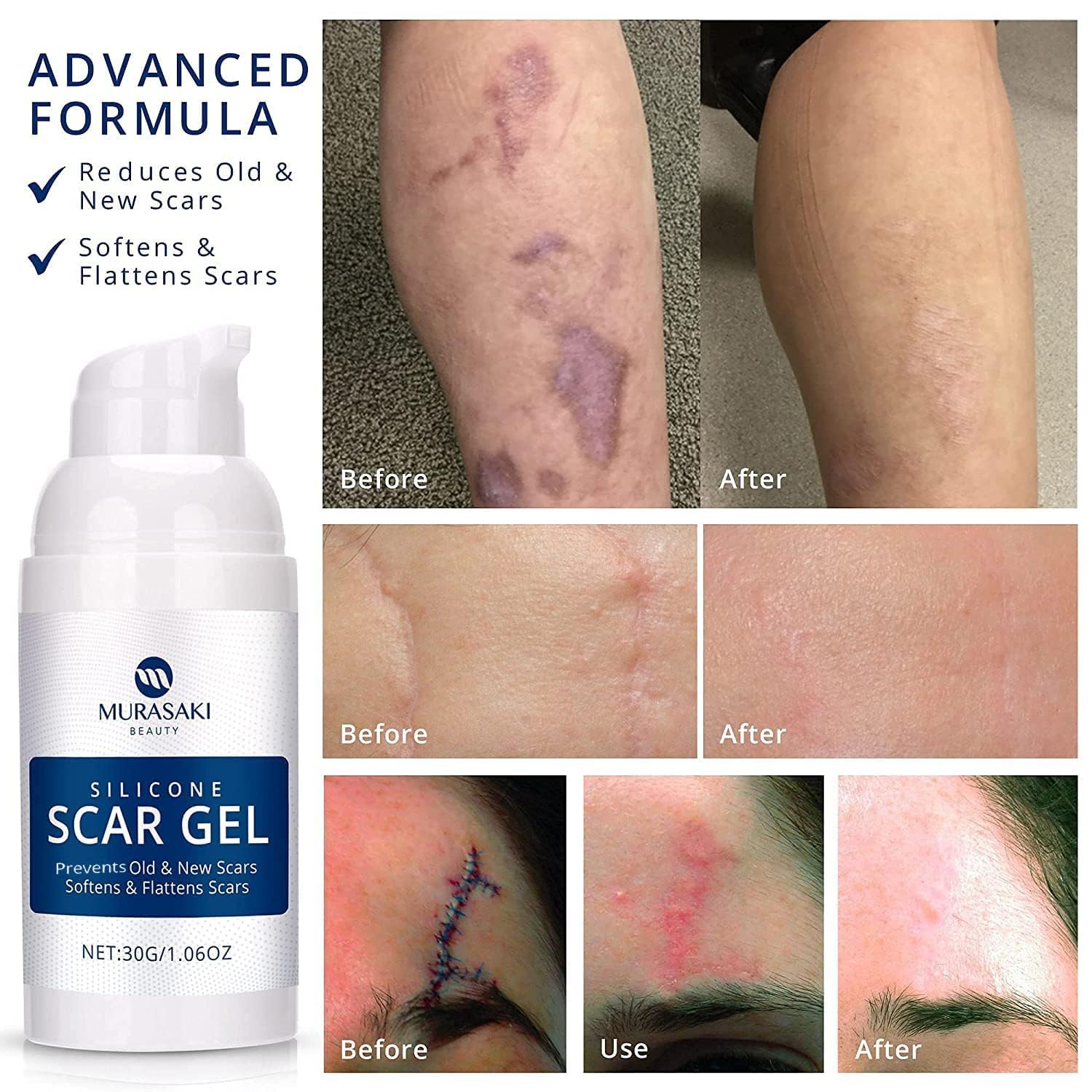 MURASAKI BEAUTY crystal-clear gel absorbs quickly into the skin