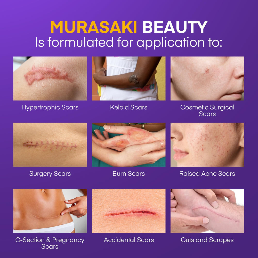 MURASAKI BEAUTY scar gel being applied with gentle massage on scar