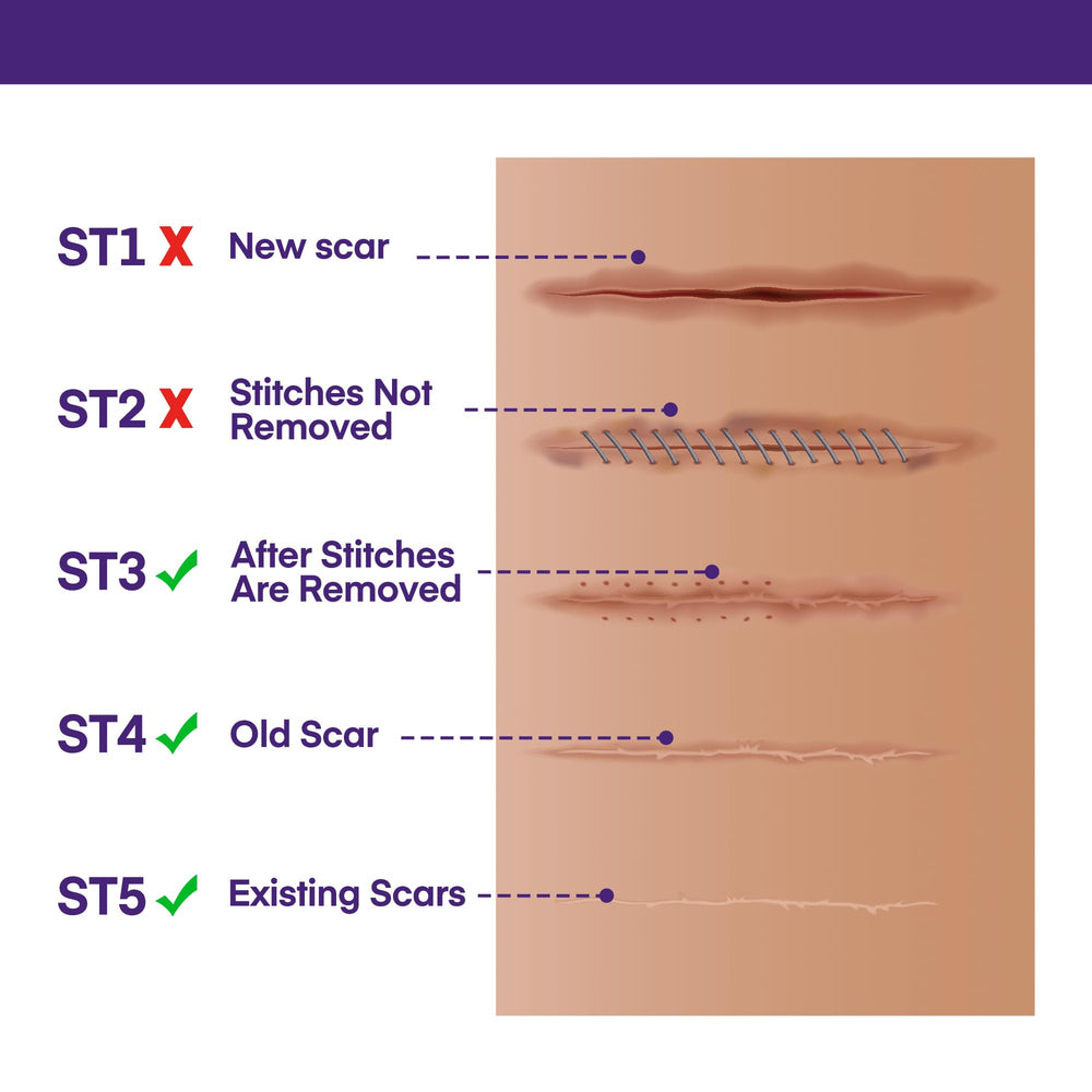 MURASAKI BEAUTY scar gel dispenser for precise application
