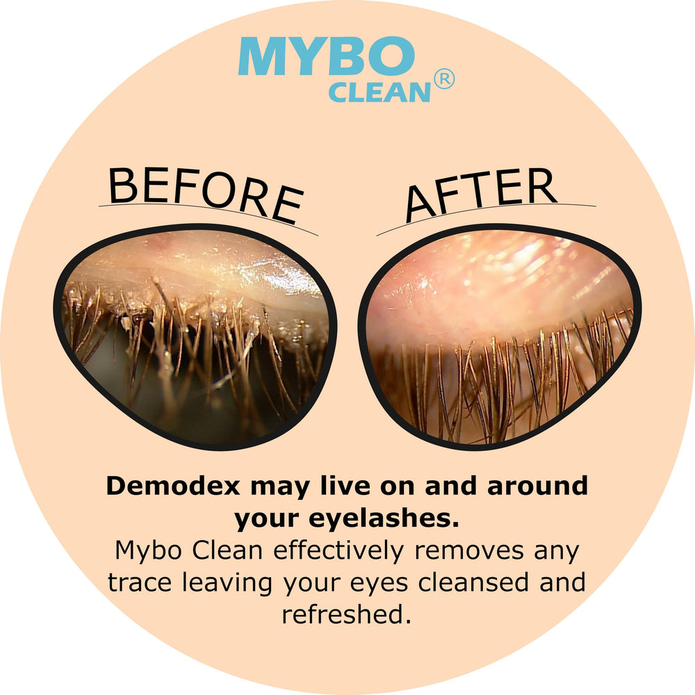 Myboclean eyelid brush bristles close-up show softness for sensitive lids