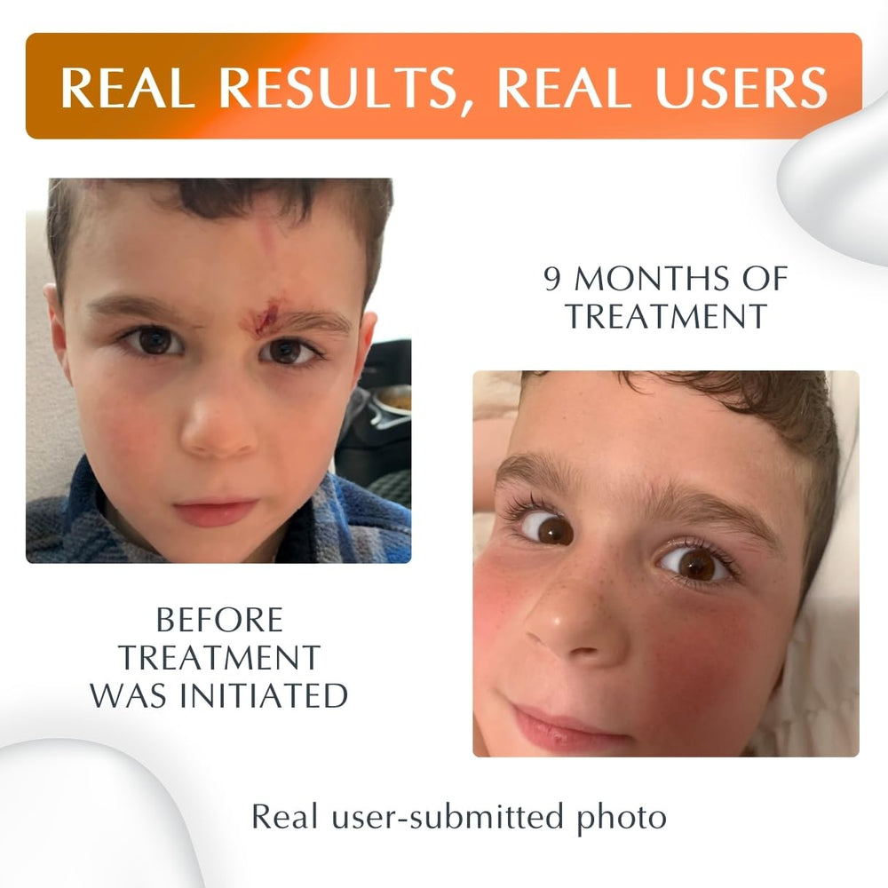 Close-up texture of MyNewGel Plus UV silicone gel for precise application