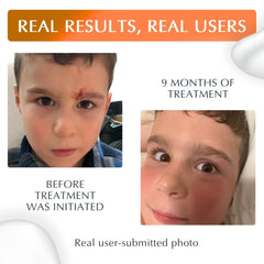 Close-up texture of MyNewGel Plus UV silicone gel for precise application