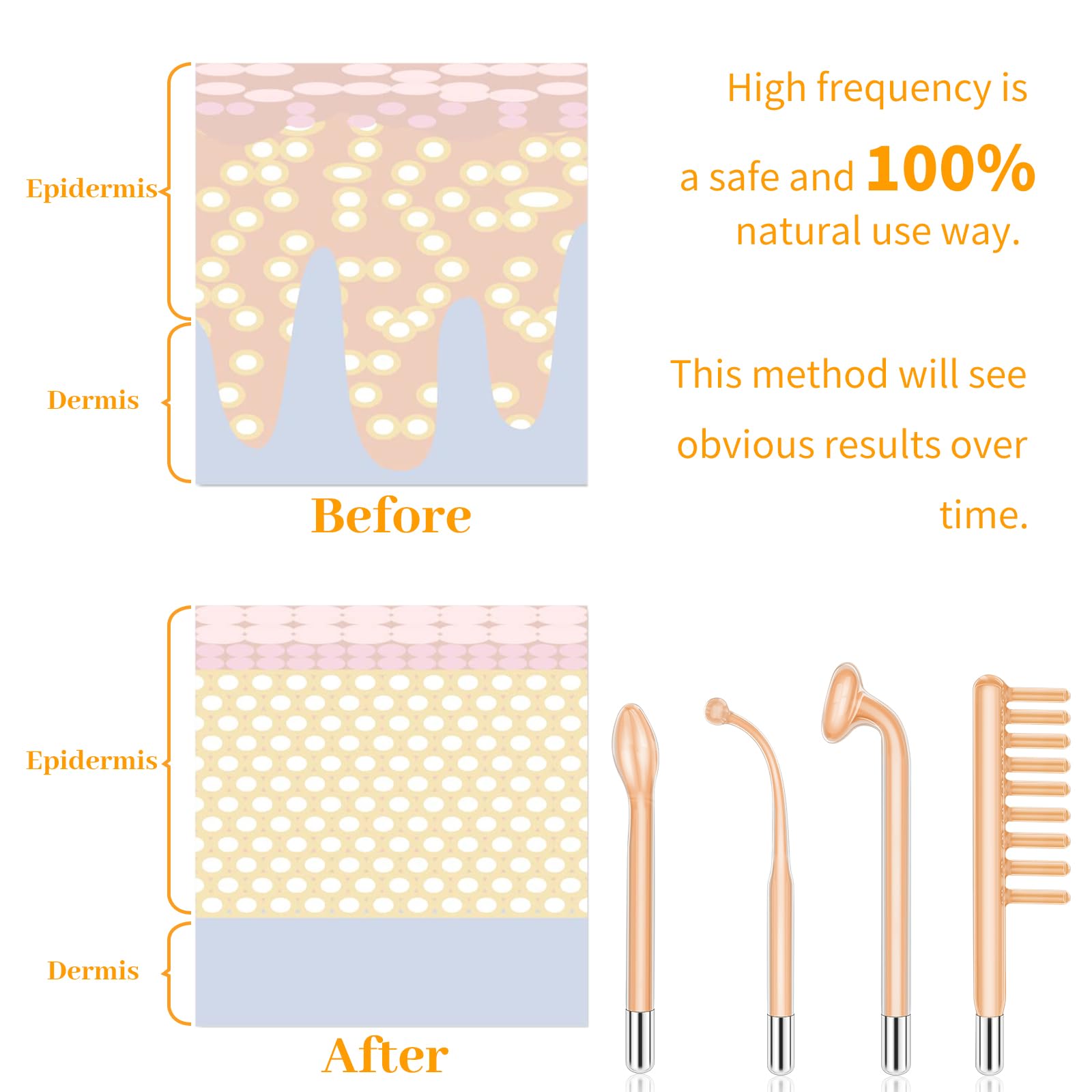 MYSWEETY high-frequency wand packaging open showing contents.