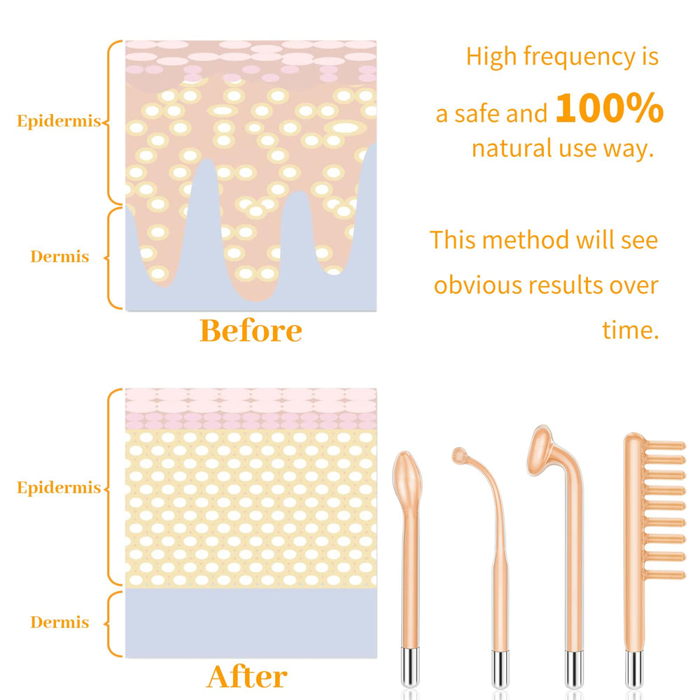 MYSWEETY high-frequency wand packaging open showing contents.