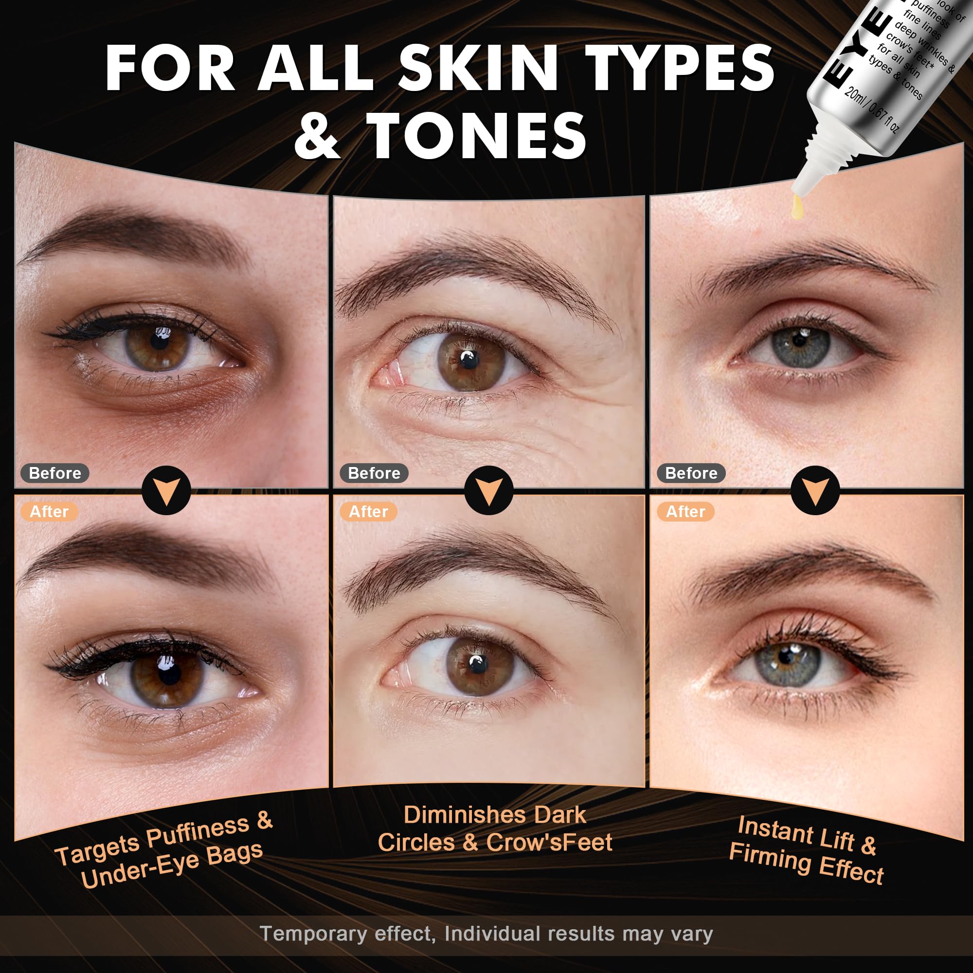 Nabevin KKP Eye Tightener 20ML travel-friendly size for daily use