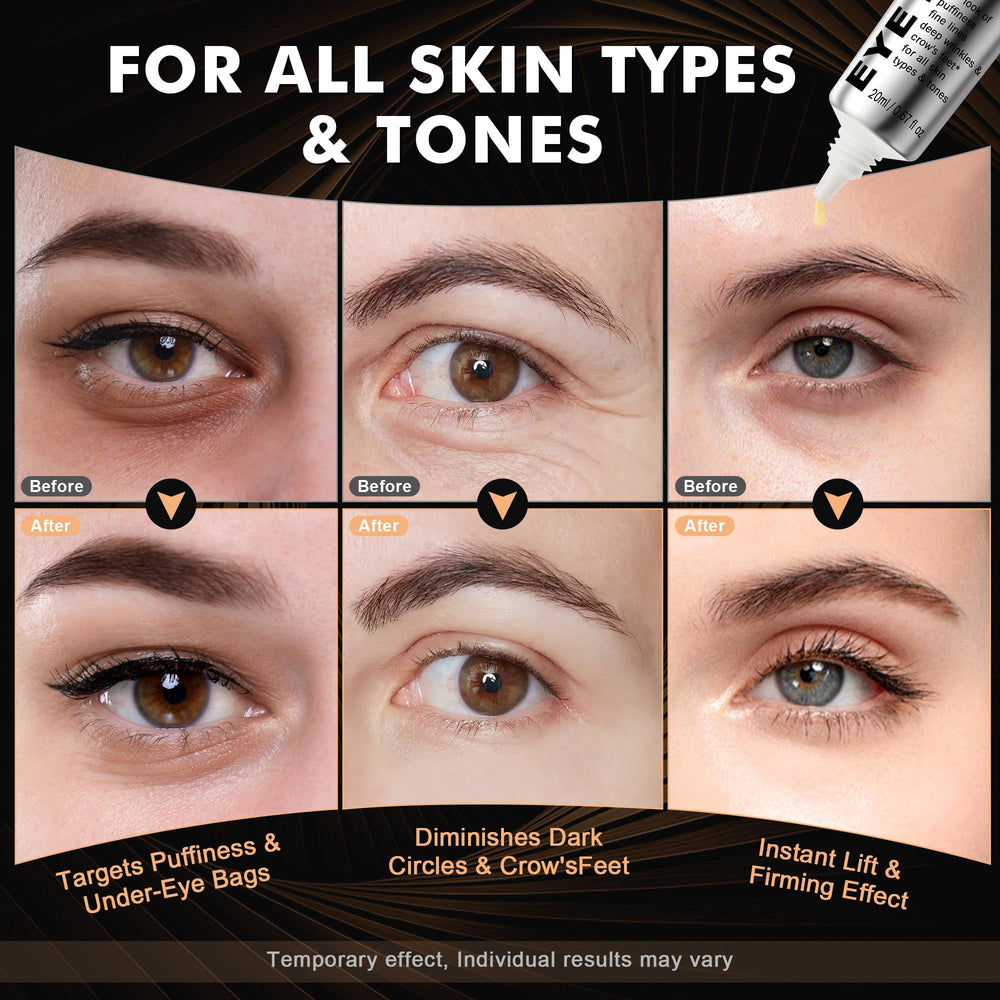 Nabevin KKP Eye Tightener 20ML travel-friendly size for daily use