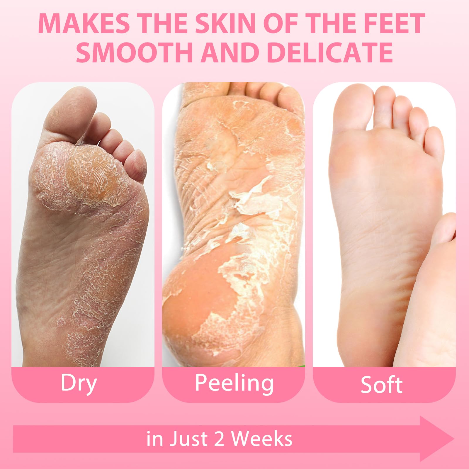 Nacerlary foot mask results after use showing smoother skin.