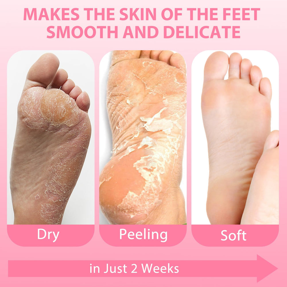 Nacerlary foot mask results after use showing smoother skin.