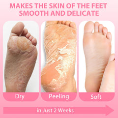Nacerlary foot mask results after use showing smoother skin.