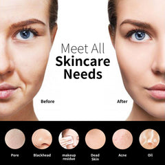 NågraCoola CLIE 2.0 silicone bristles show gentle daily cleansing.