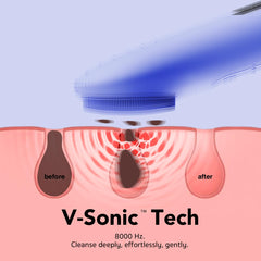 NågraCoola CLIE blue brush with silicone tips for thorough cleansing