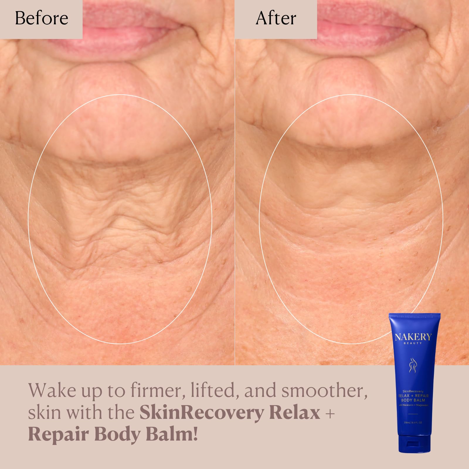 Nakery SkinRecovery crema hidratante para piel seca, nutre y suaviza.