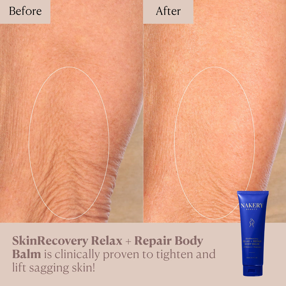 Nakery SkinRecovery cuidado para mujeres: mejora firmeza e hidratación en el cuerpo.