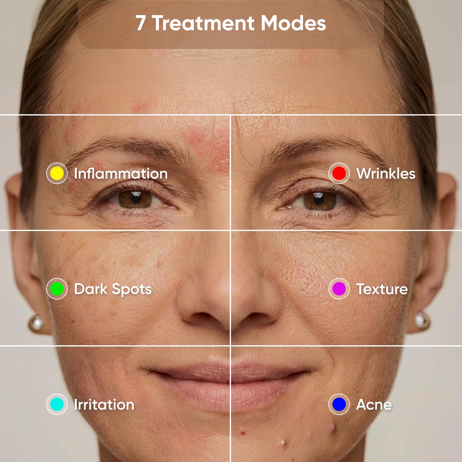Nanoleaf LED therapy mask side profile for comfortable wear during routines
