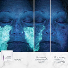 NassifMD Detox Pads close-up texture highlighting gentle exfoliation for smoother skin.