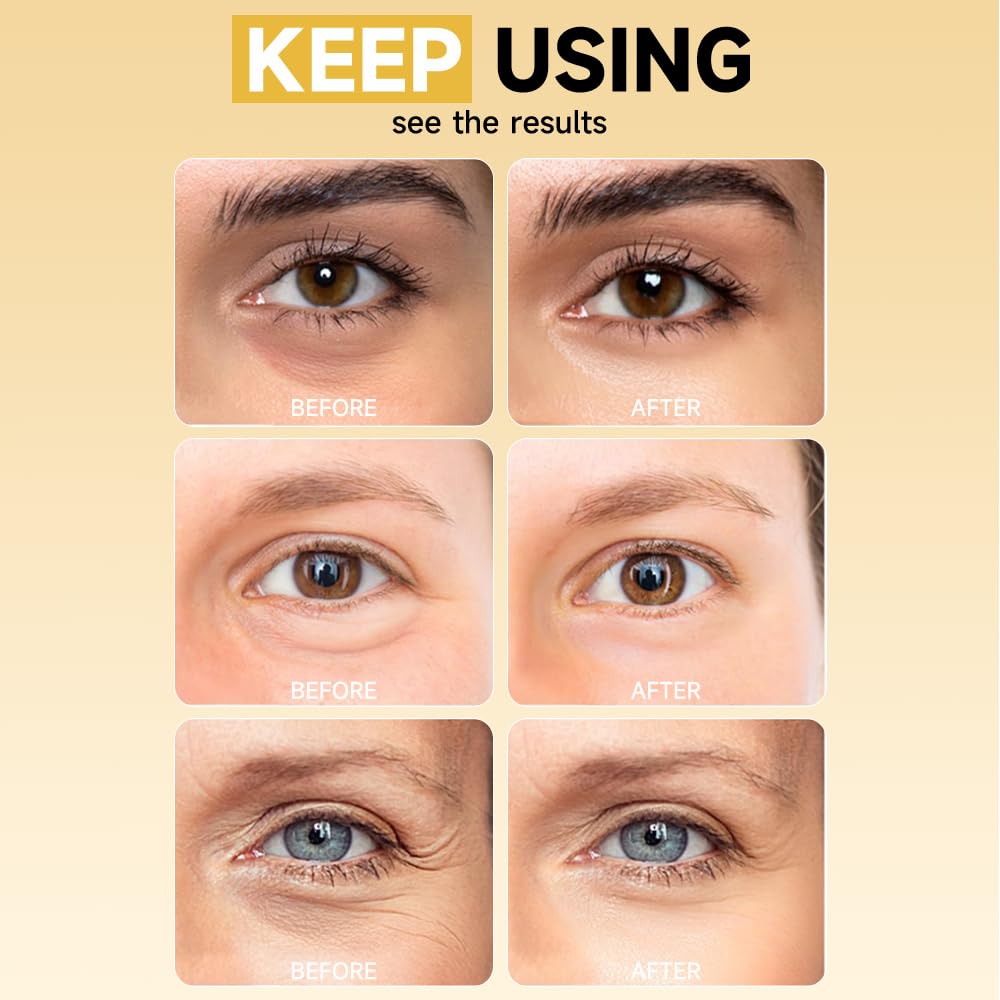 Natener hyaluronic acid providing deep moisture under the eyes.