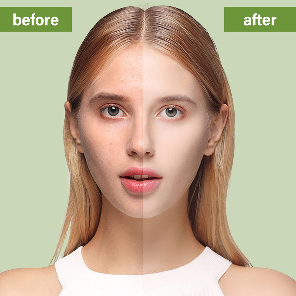 Natura Derm ritual diario arbol de te para piel limpia y fresca.