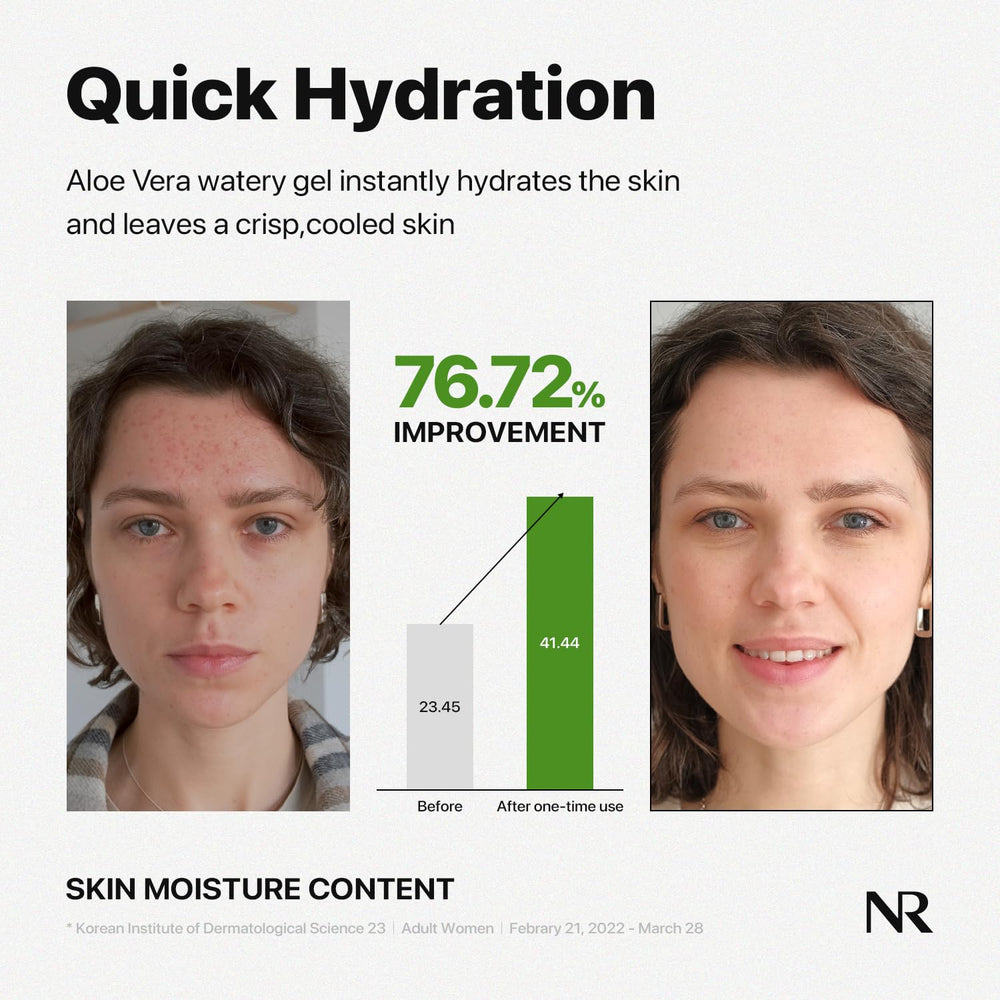 Gel refrescante tras sol para calmar la piel cansada.