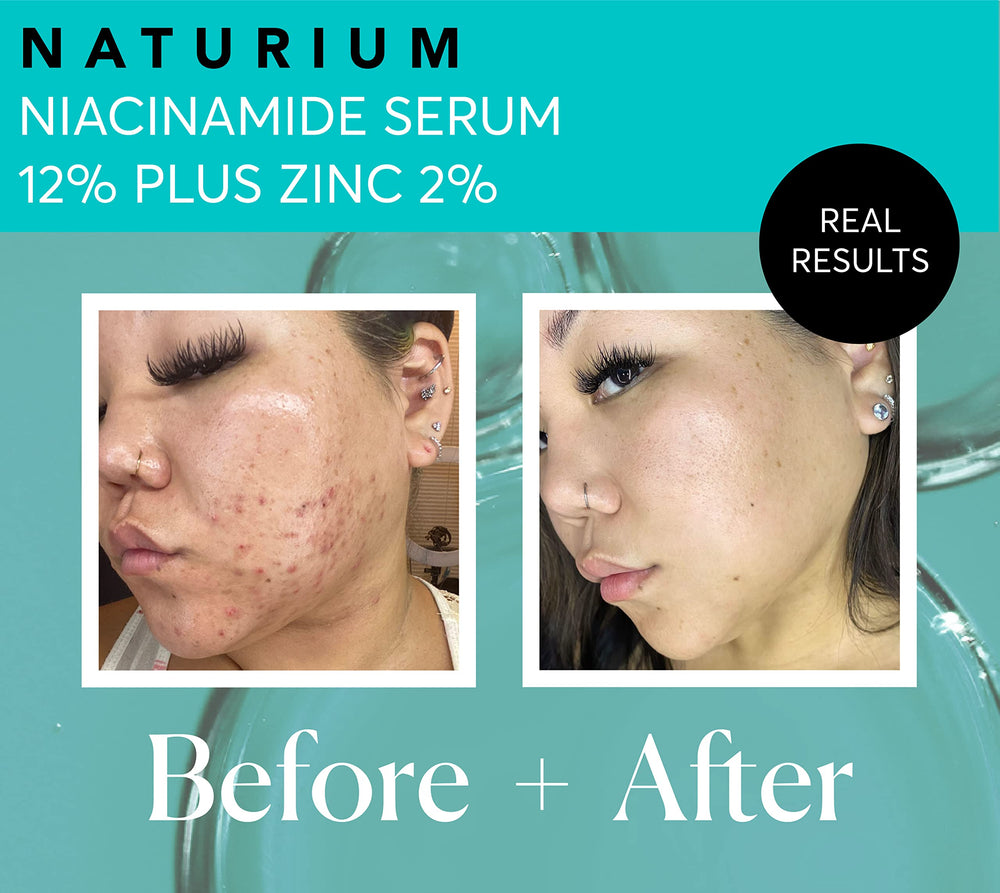 Naturium 2oz jumbo packaging ideal for extended skincare routine