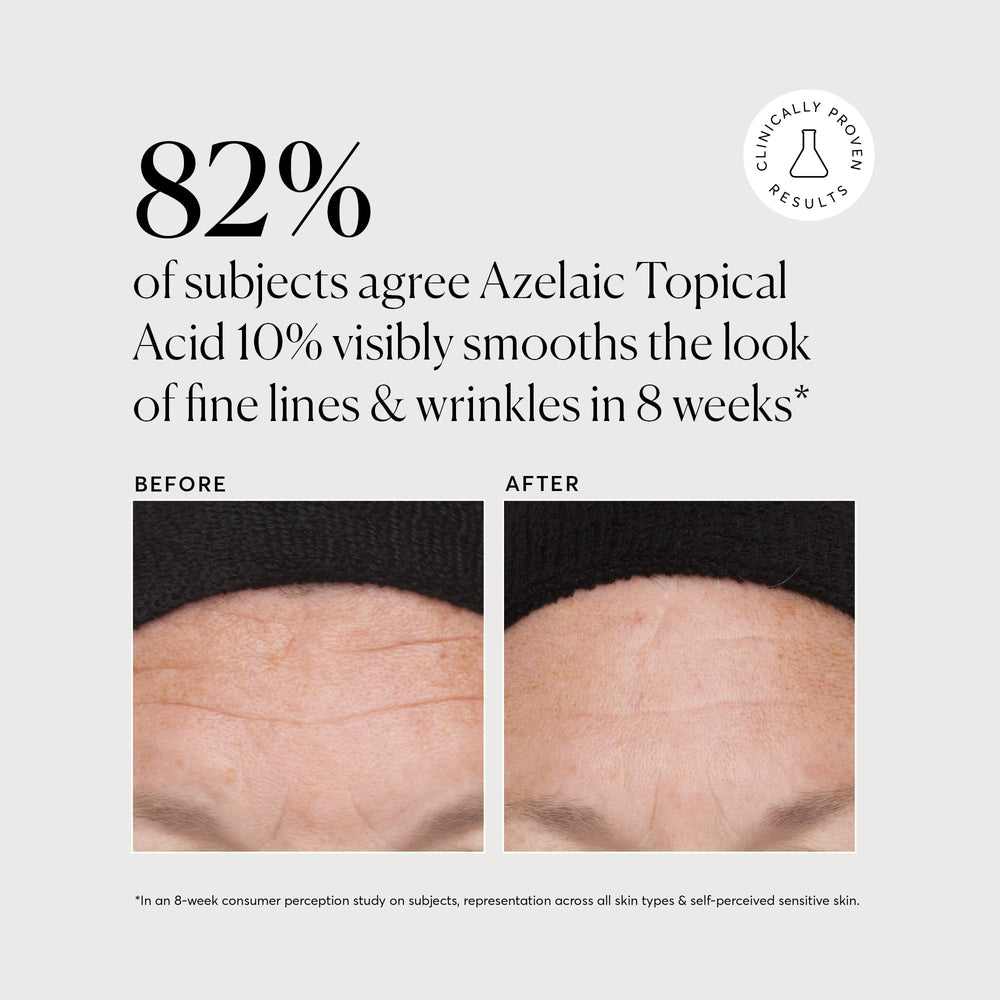 Naturium Azelaic Topical Acid 10% texture closeup reveals creamy, lightweight formula