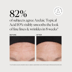 Naturium Azelaic Topical Acid 10% texture closeup reveals creamy, lightweight formula