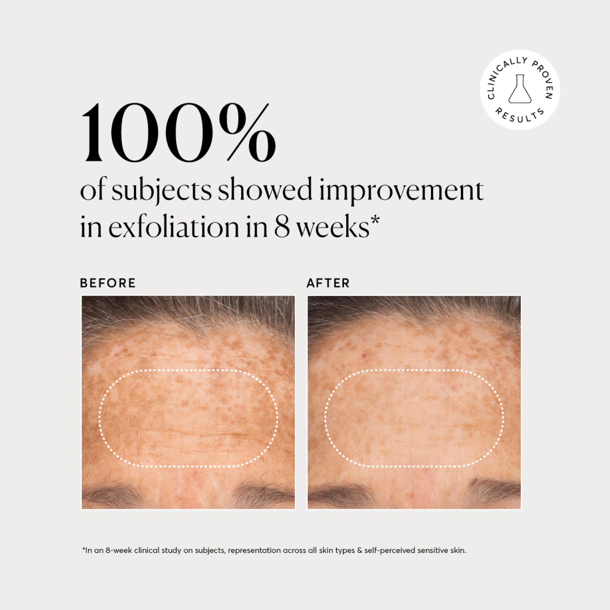 Naturium BHA Liquid Exfoliant closeup-ingredients reveals bioactive acids at work.