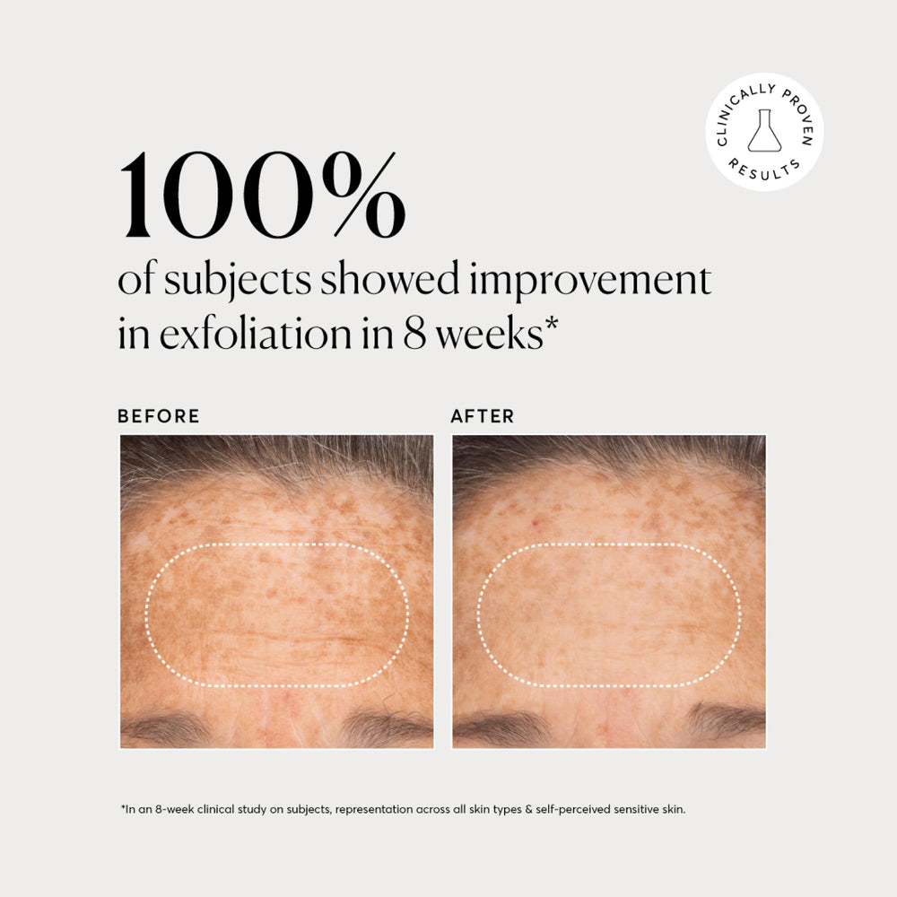 Naturium BHA Liquid Exfoliant closeup-ingredients reveals bioactive acids at work.