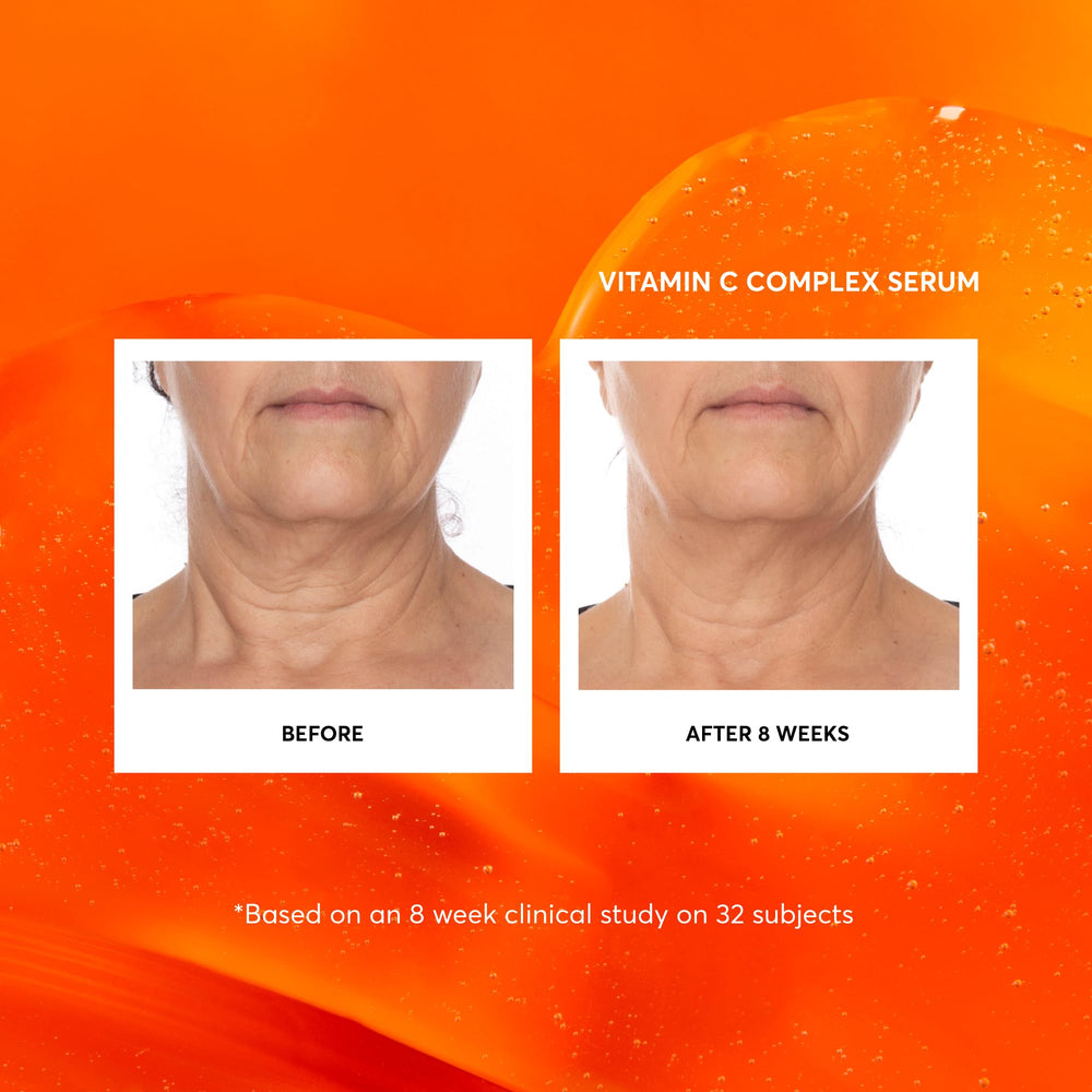 Naturium Vitamin C Complex Serum 2oz packaging displayed on shelf