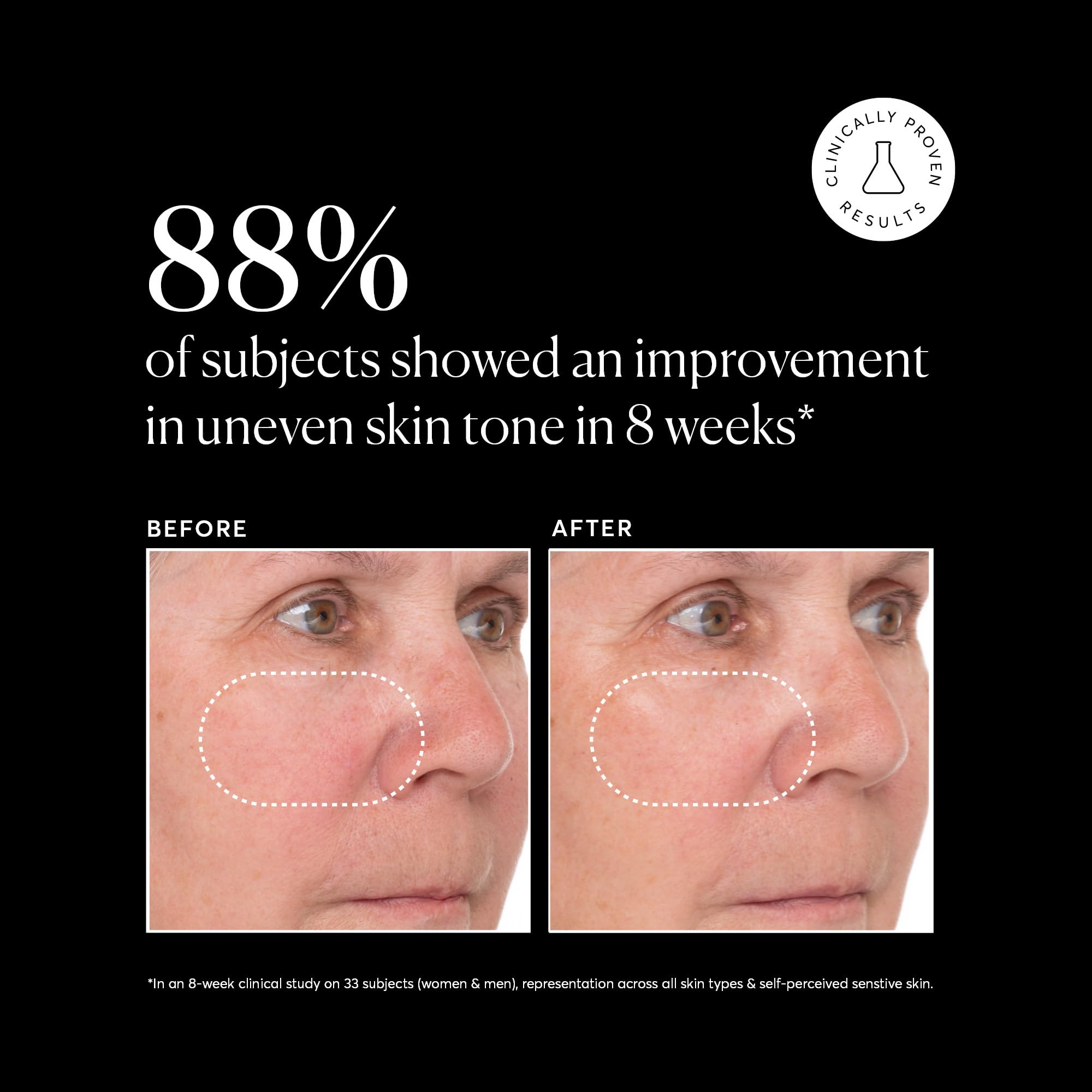 Naturium Vitamin C Super Serum Plus combines niacinamide and salicylic acid for clearer-looking skin.
