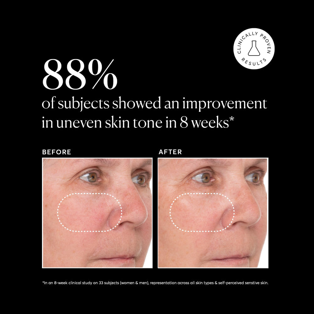 Naturium Vitamin C Super Serum Plus combines niacinamide and salicylic acid for clearer-looking skin.