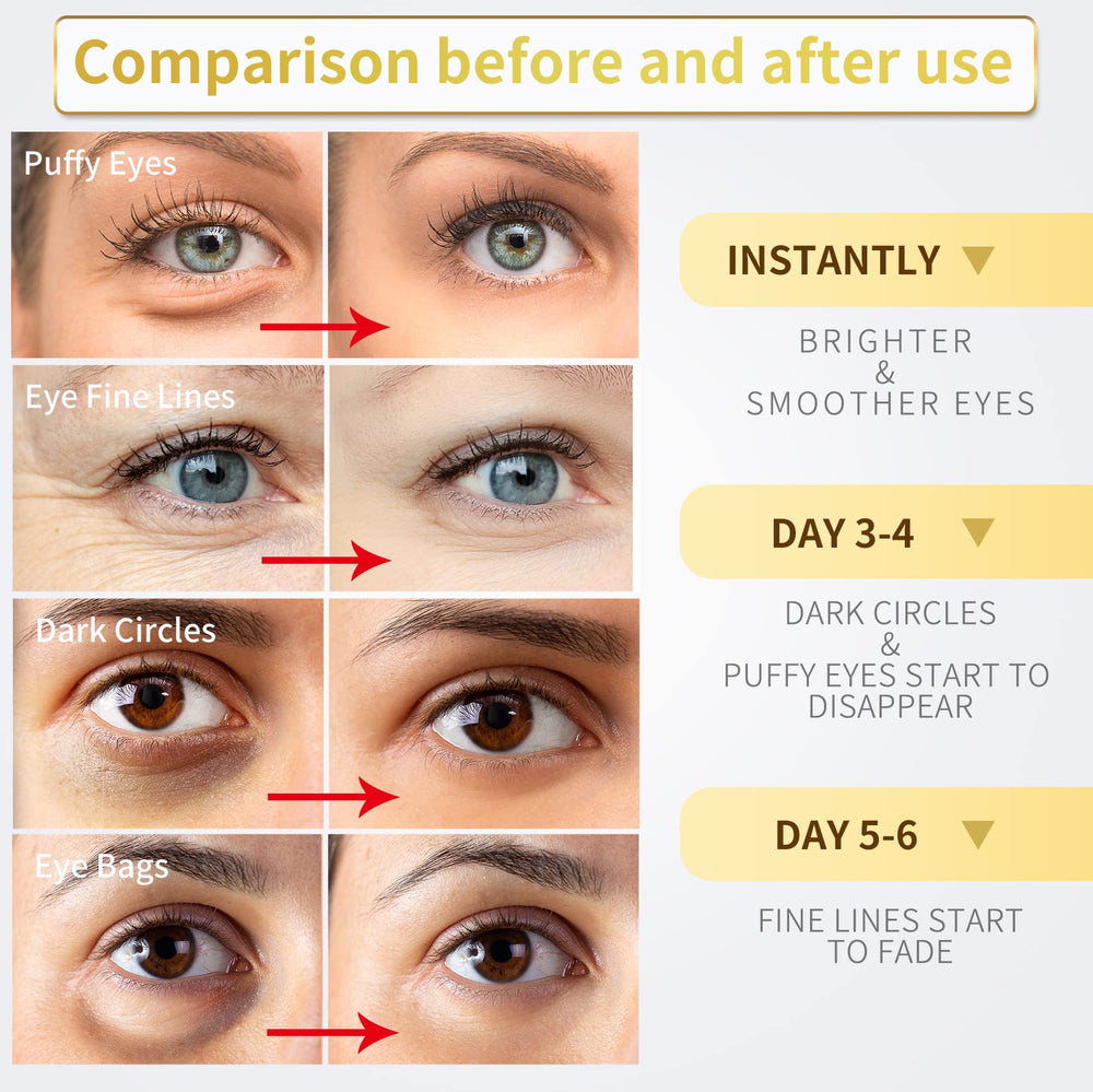 NAZANO parches ojos oro 24k: textura suave para piel delicada