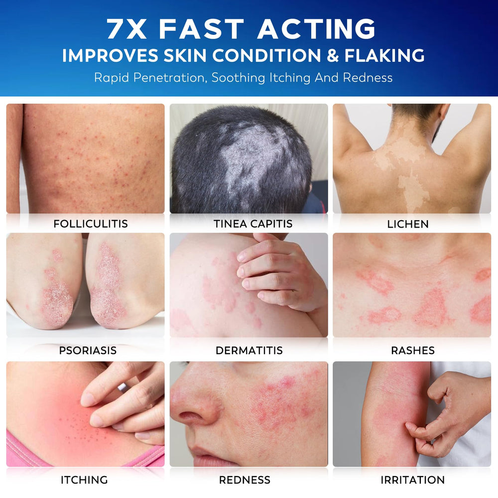 Nedtol Folliculitis Treatment Cream on the face reduces redness