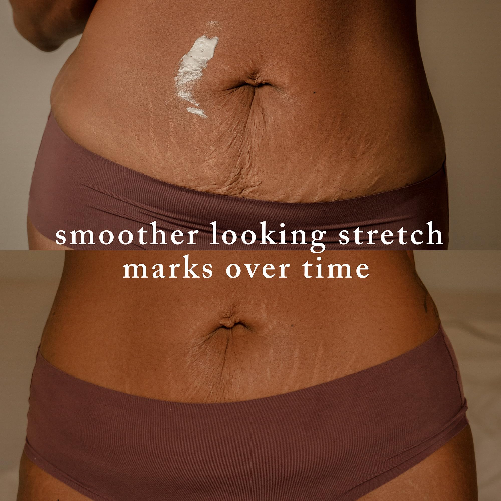 Nemah Stretch Mark Cream being used in morning and evening routines for targeted support.