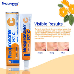 Neoprosone Crema Iluminadora: ingredientes Vitamina C para antioxidantes y protección