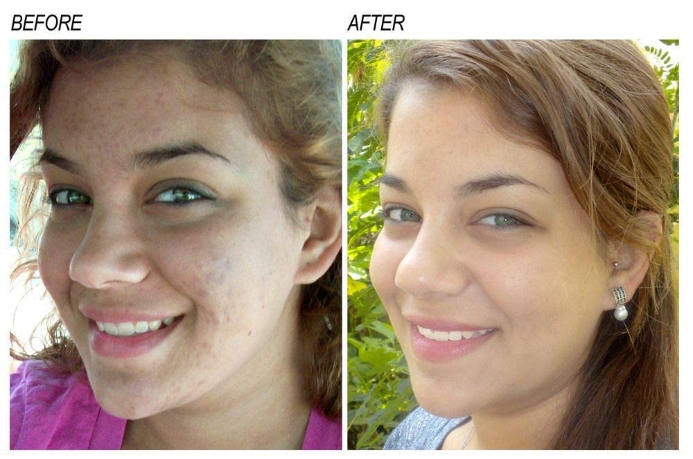 Neoprosone serum vitamina C: aplicación nocturna para mayor luminosidad.