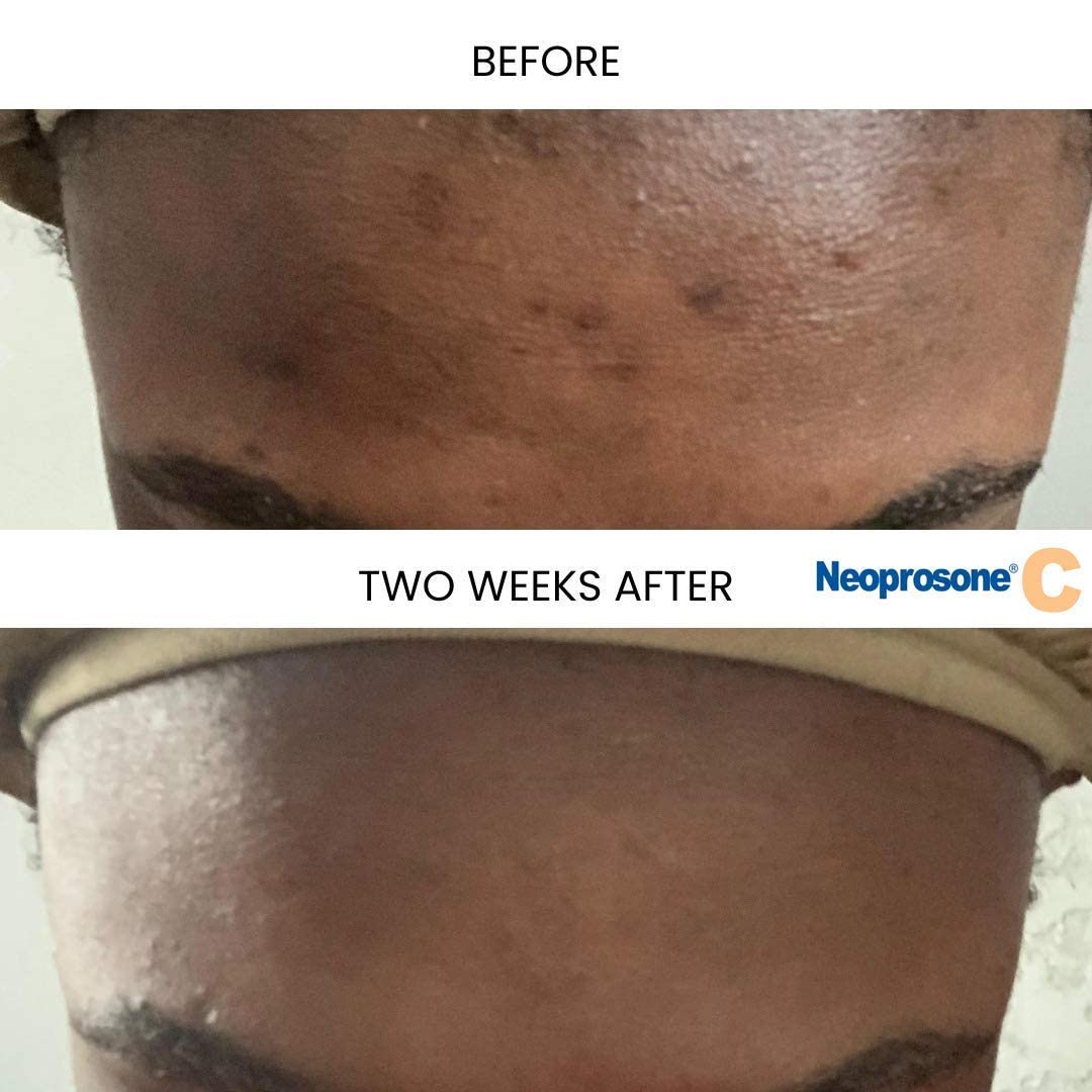 Textura cremosa de Neoprosone serum para uso diario.