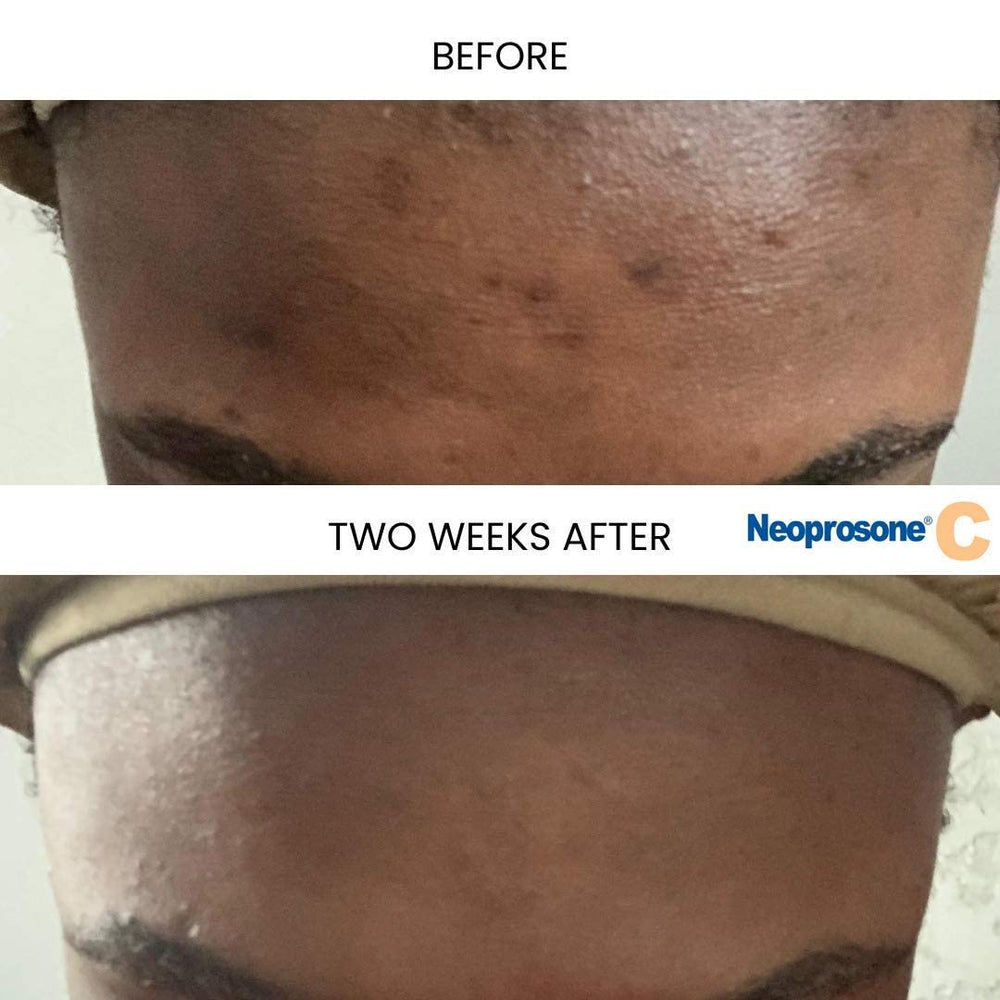 Textura cremosa de Neoprosone serum para uso diario.