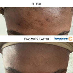 Textura cremosa de Neoprosone serum para uso diario.