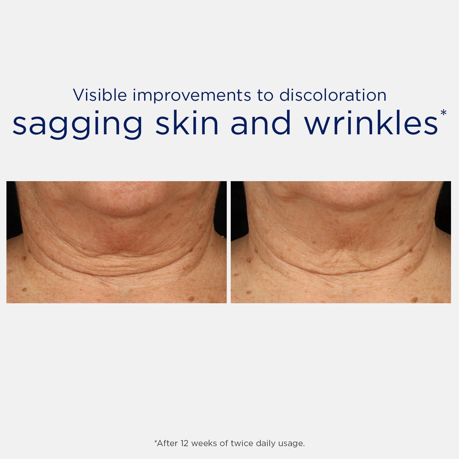 NEOSTRATA triple firming formula absorption, fragrance-free and gentle on skin.