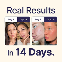 Neptune Health balm applied to face and body for daily moisture