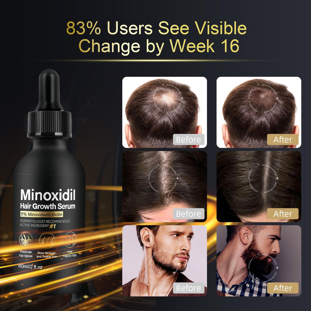 NETYIYUN Minoxidil packaging box clearly communicates dosage and formula