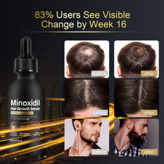 NETYIYUN Minoxidil packaging box clearly communicates dosage and formula