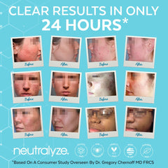 Neutralyze limpiador facial 2.0 ayuda a igualar el tono de piel