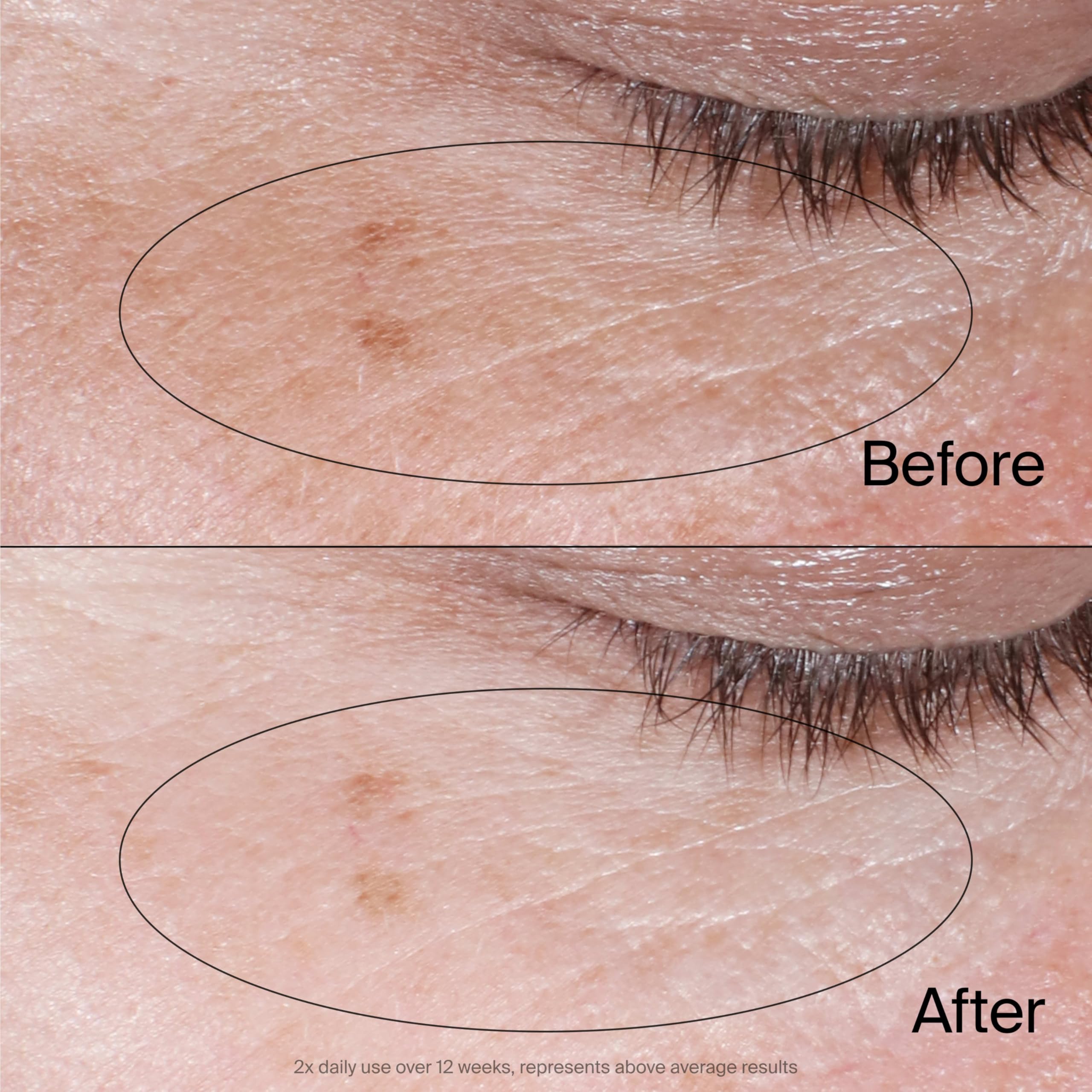 Neutrogena Collagen Bank Reviving Eye Cream, sin fragancia, ideal para piel sensible