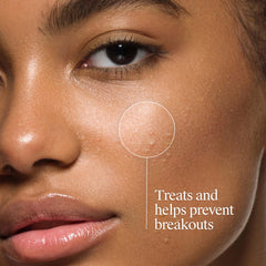 Neutrogena Control de acne, elimina aceite y desobstruye poros.