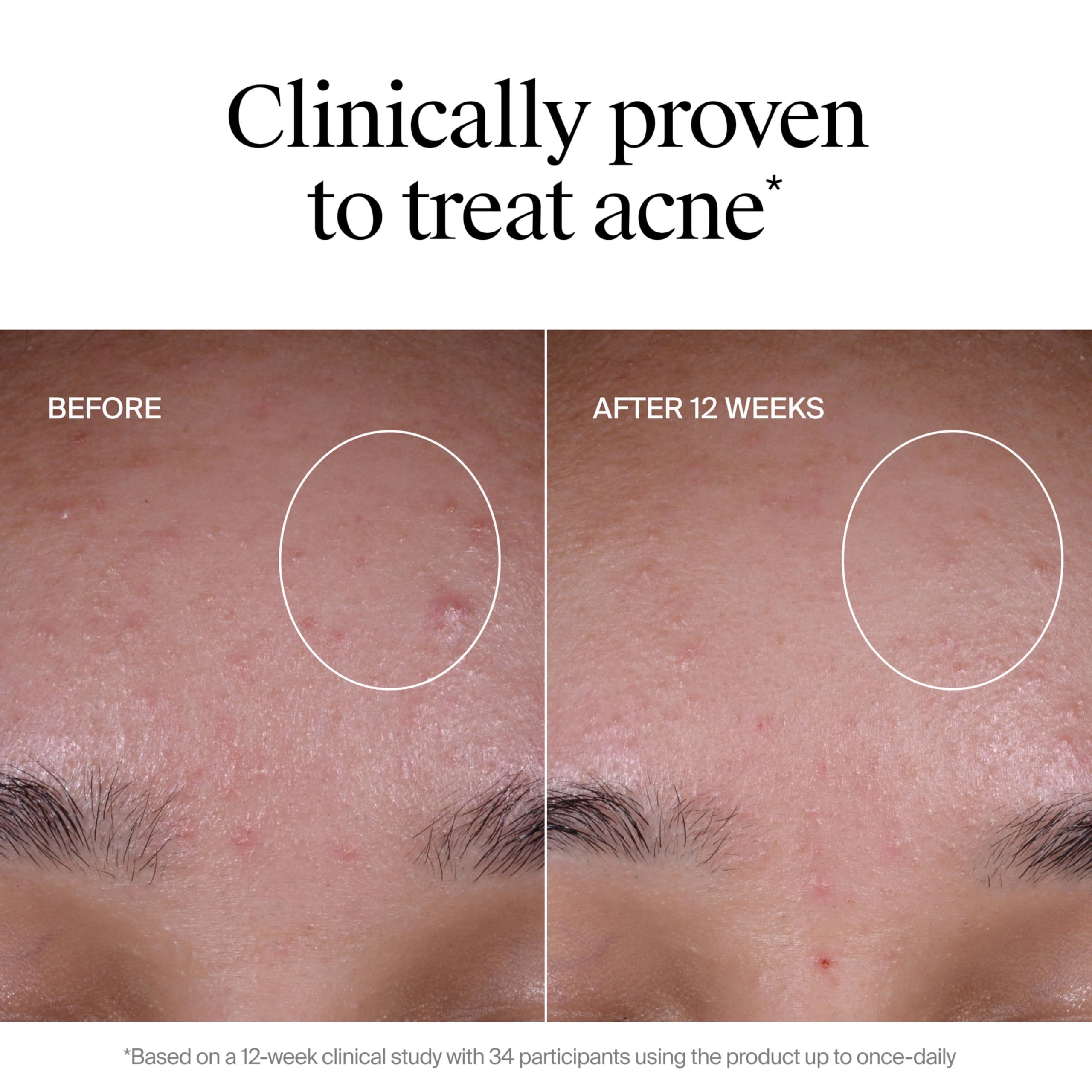 Neutrogena Evenly Clear Exfoliante, rápida absorción sin grasa.